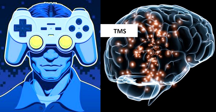 The Positive and Negative Effects of Gaming on the Human Brain